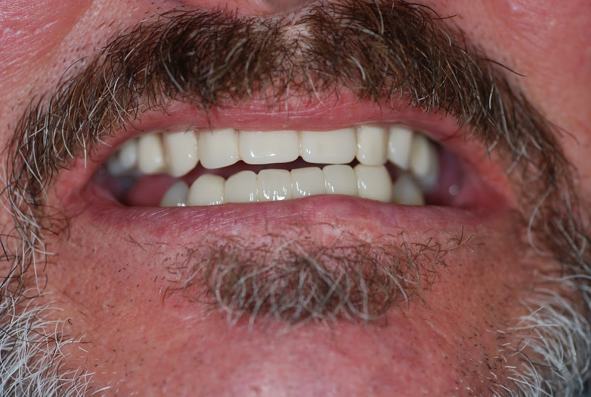 Premier Oral Facial & Implant Surgery photo 5
