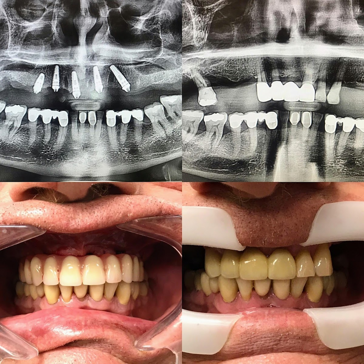 Denture Specialists photo 2