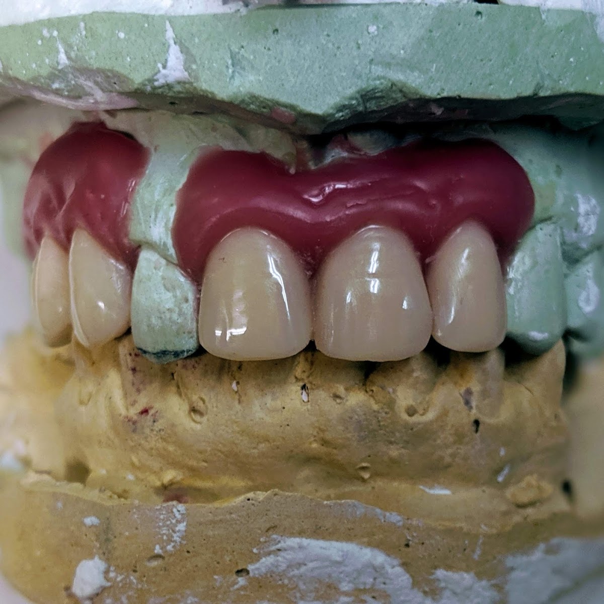 Denture Specialists photo 4