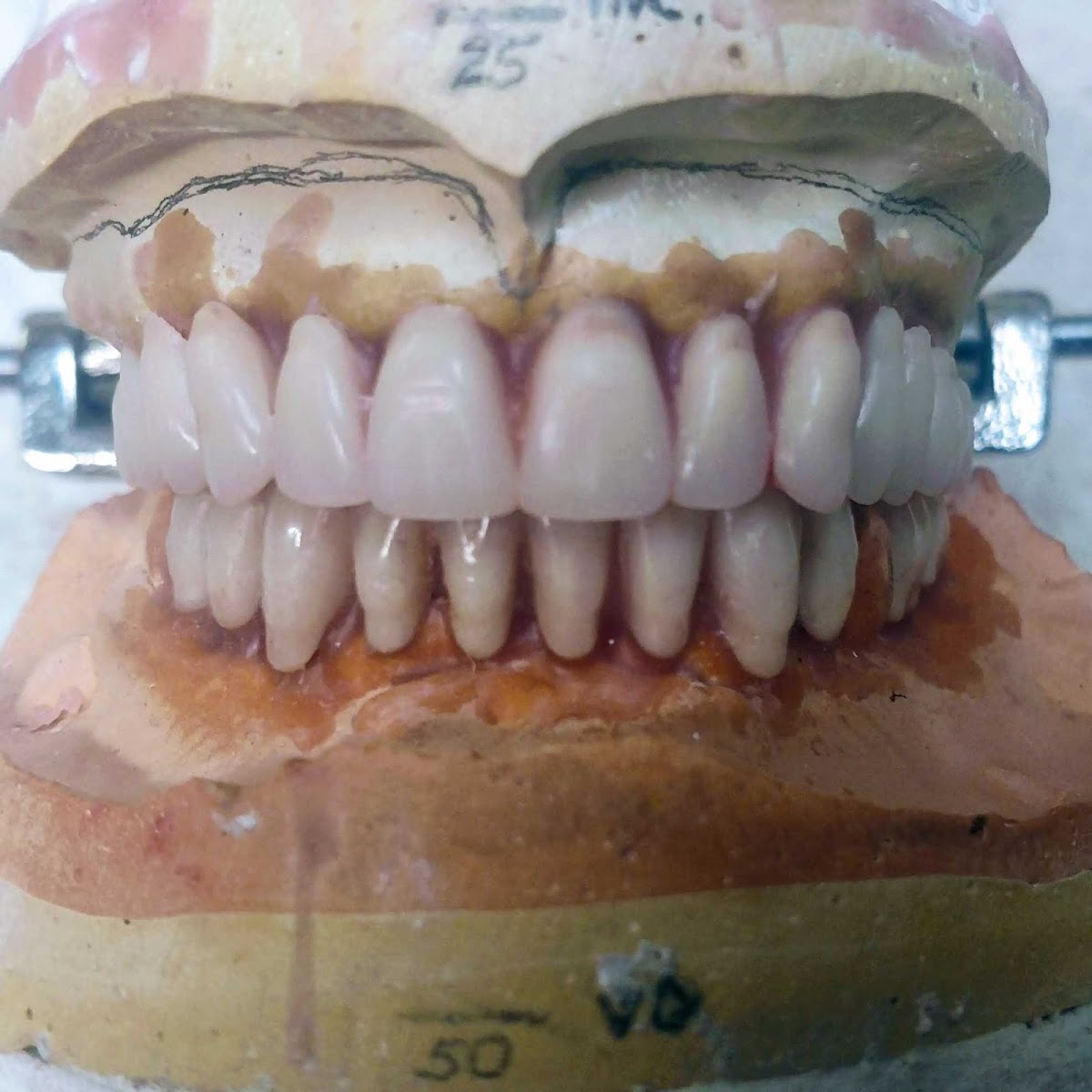 Denture Specialists photo 6