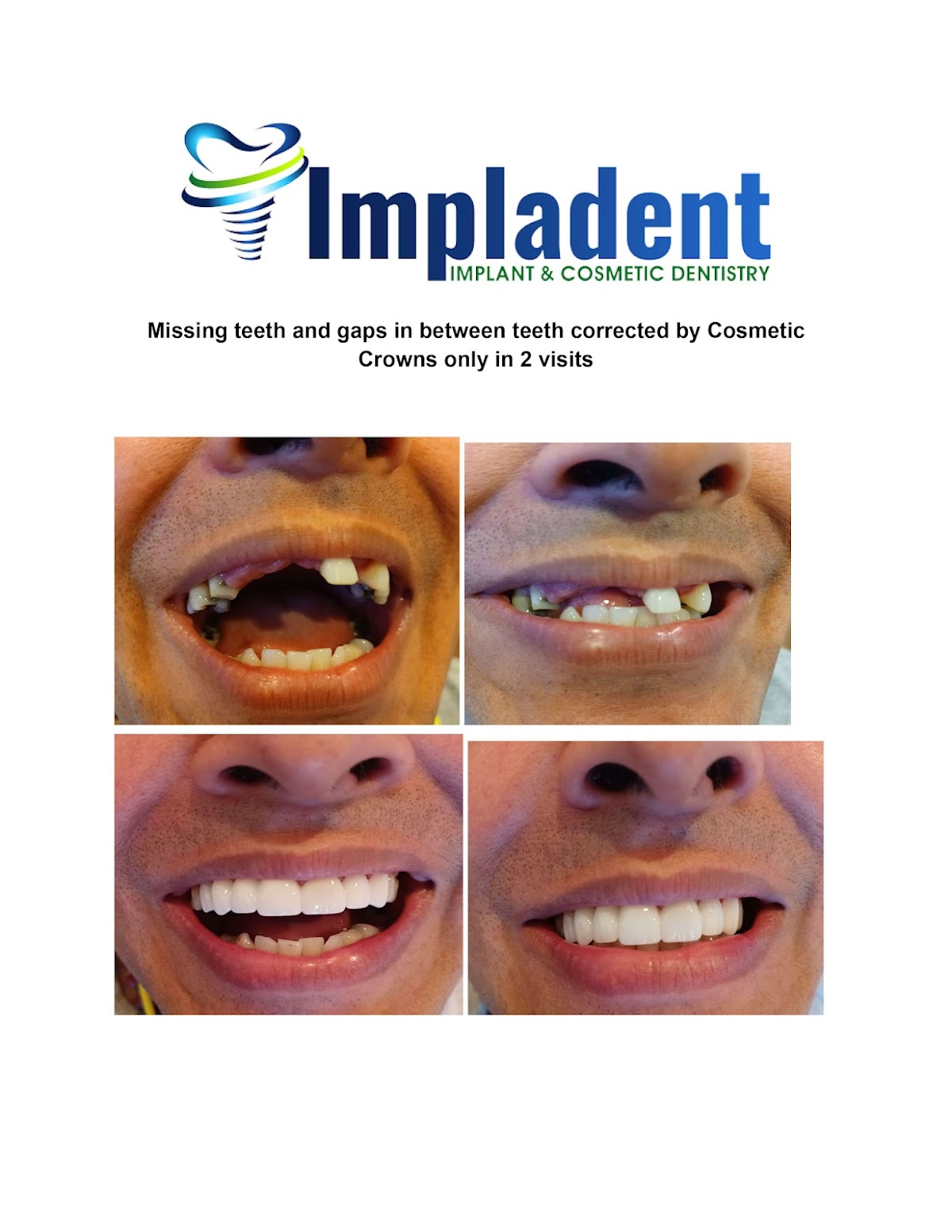 Impladent Implant & Cosmetic Dentistry photo 5