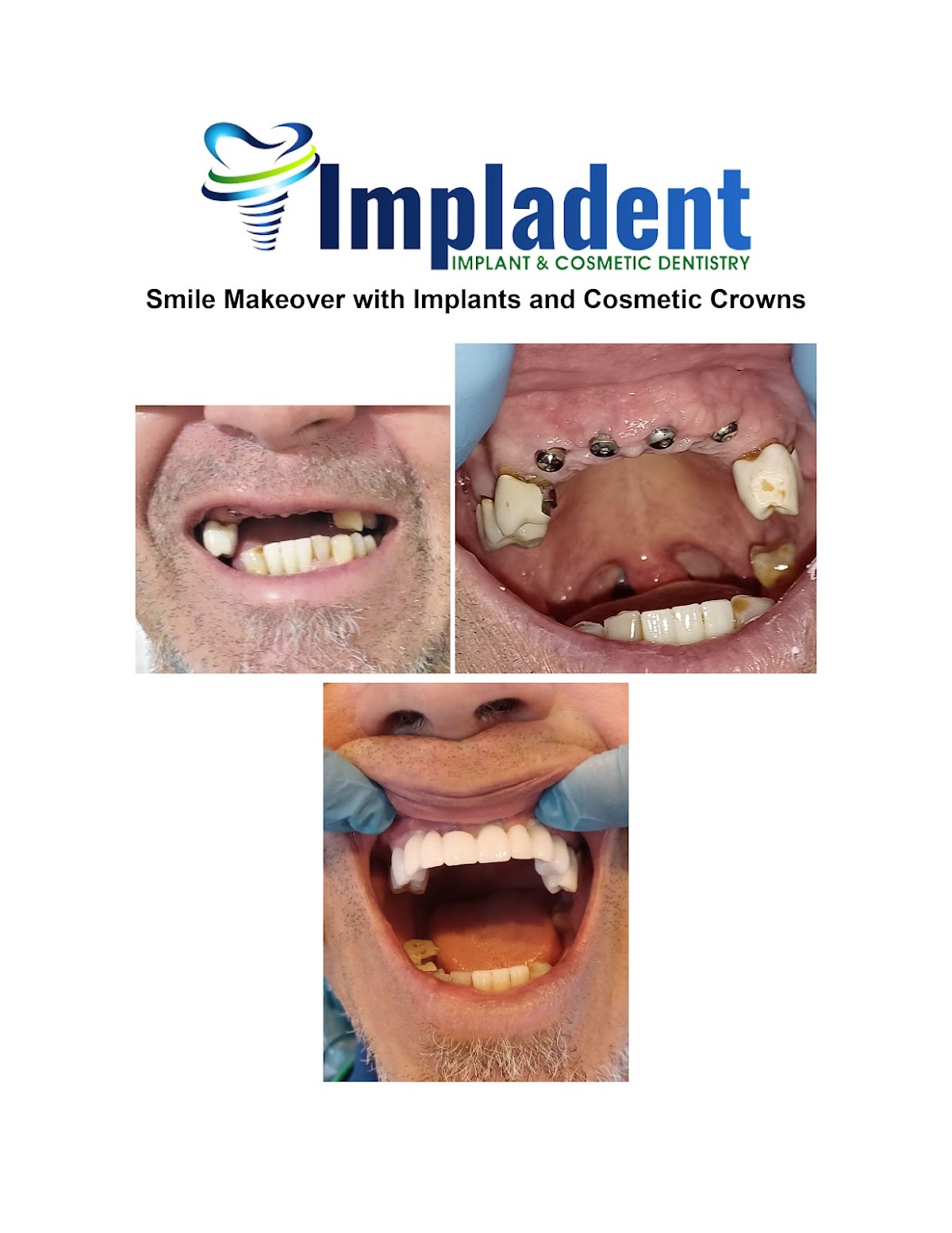 Impladent Implant & Cosmetic Dentistry photo 6