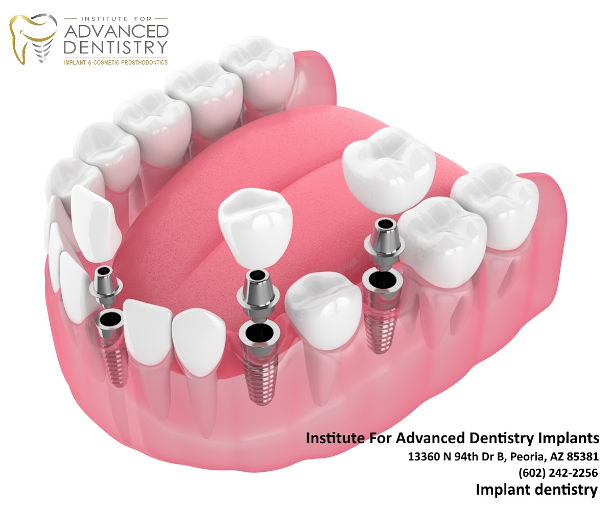 Institute for Advanced Dentistry & Implants photo 5