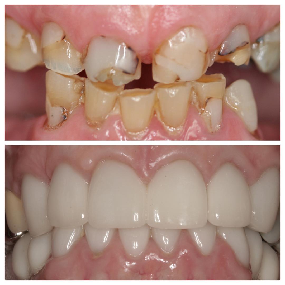 Platinum Dental of Logan photo 6