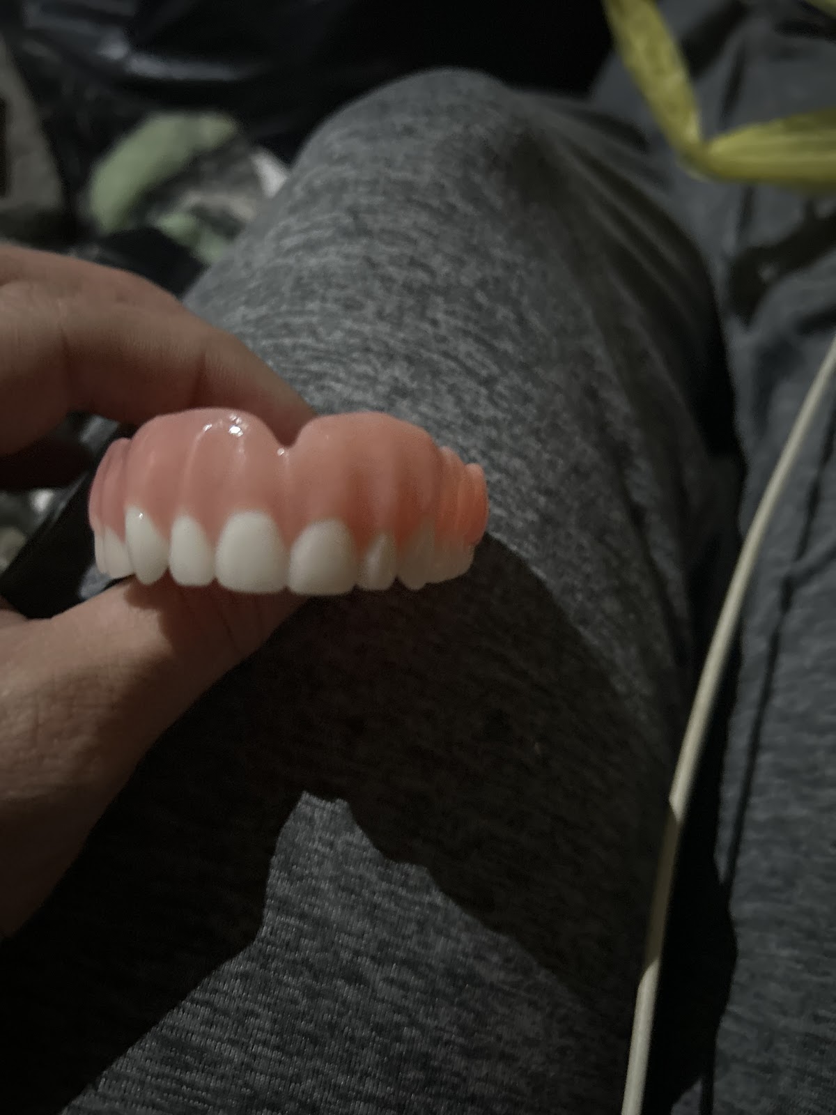 Aspen Dental - Muncie photo 3