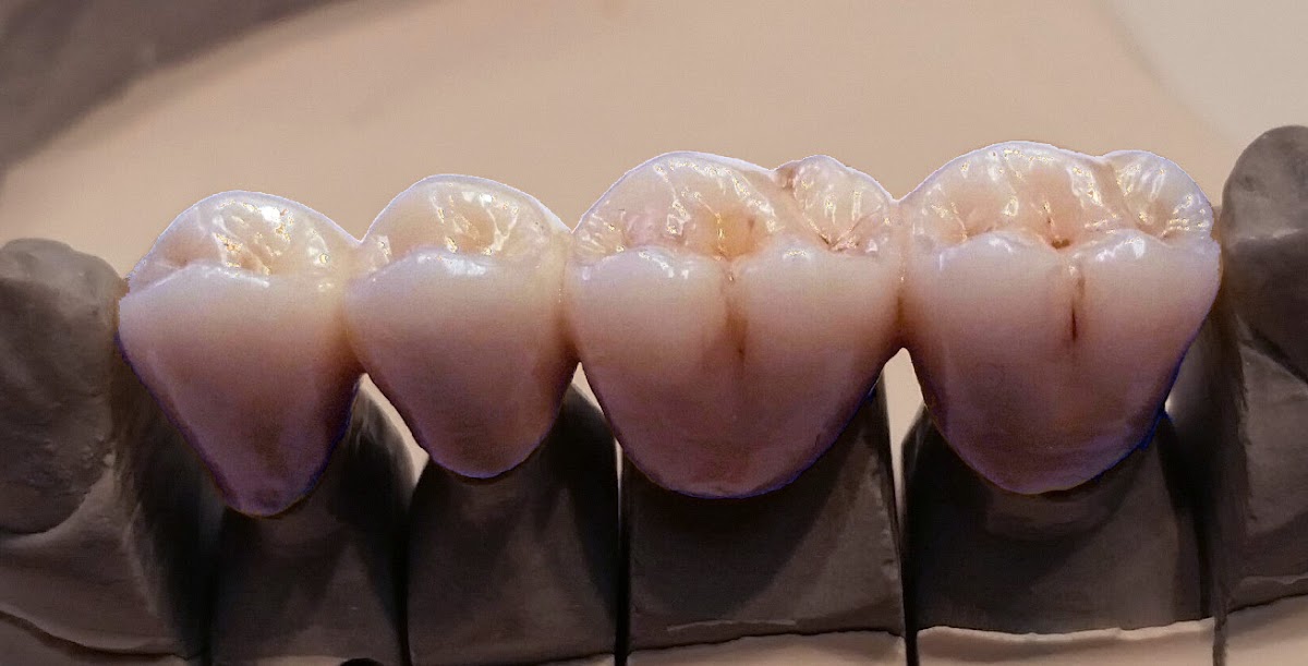 Authentic Dental Laboratory, Inc. photo 5