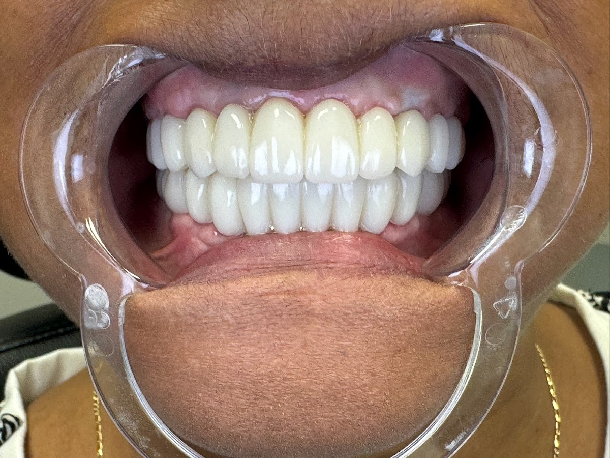 All Out Dental photo 6
