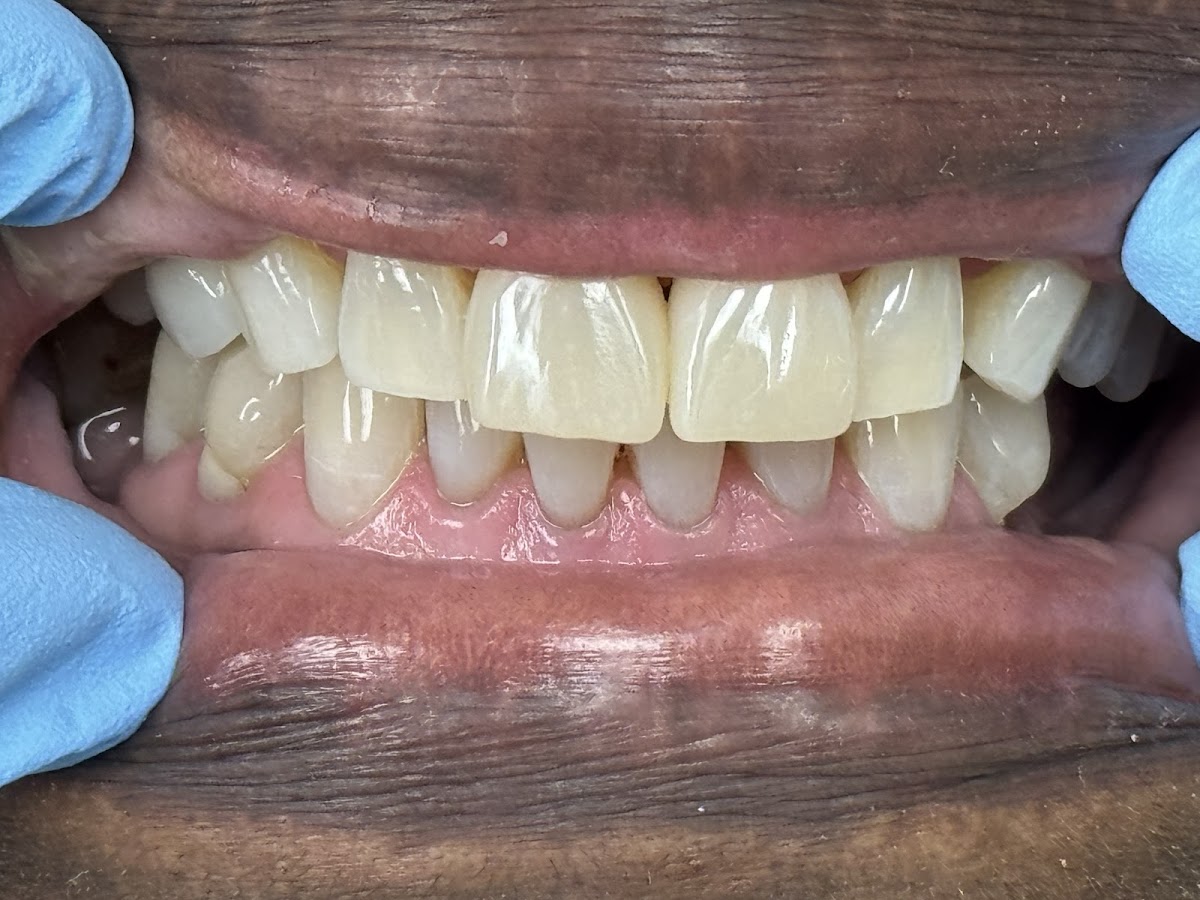 Kissimmee Dentist - Prestige Dental - Dr. Qi Wang, DDS - Emergency & Cosmetic Dentist Kissimmee photo 4