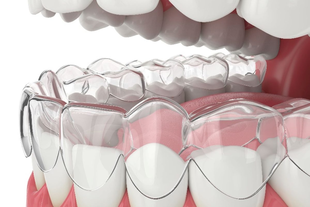 Kissimmee Dentist - Prestige Dental - Dr. Qi Wang, DDS - Emergency & Cosmetic Dentist Kissimmee photo 6