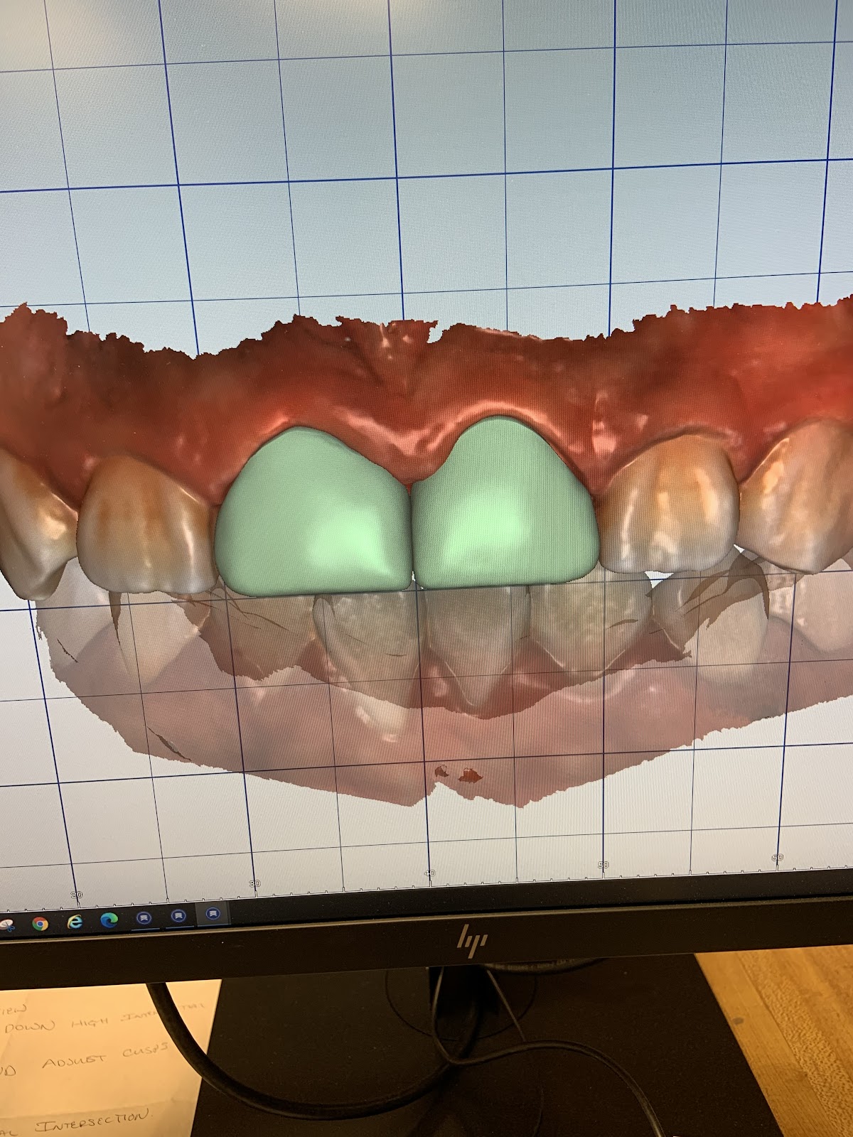 Lake Wales Dental Group photo 4