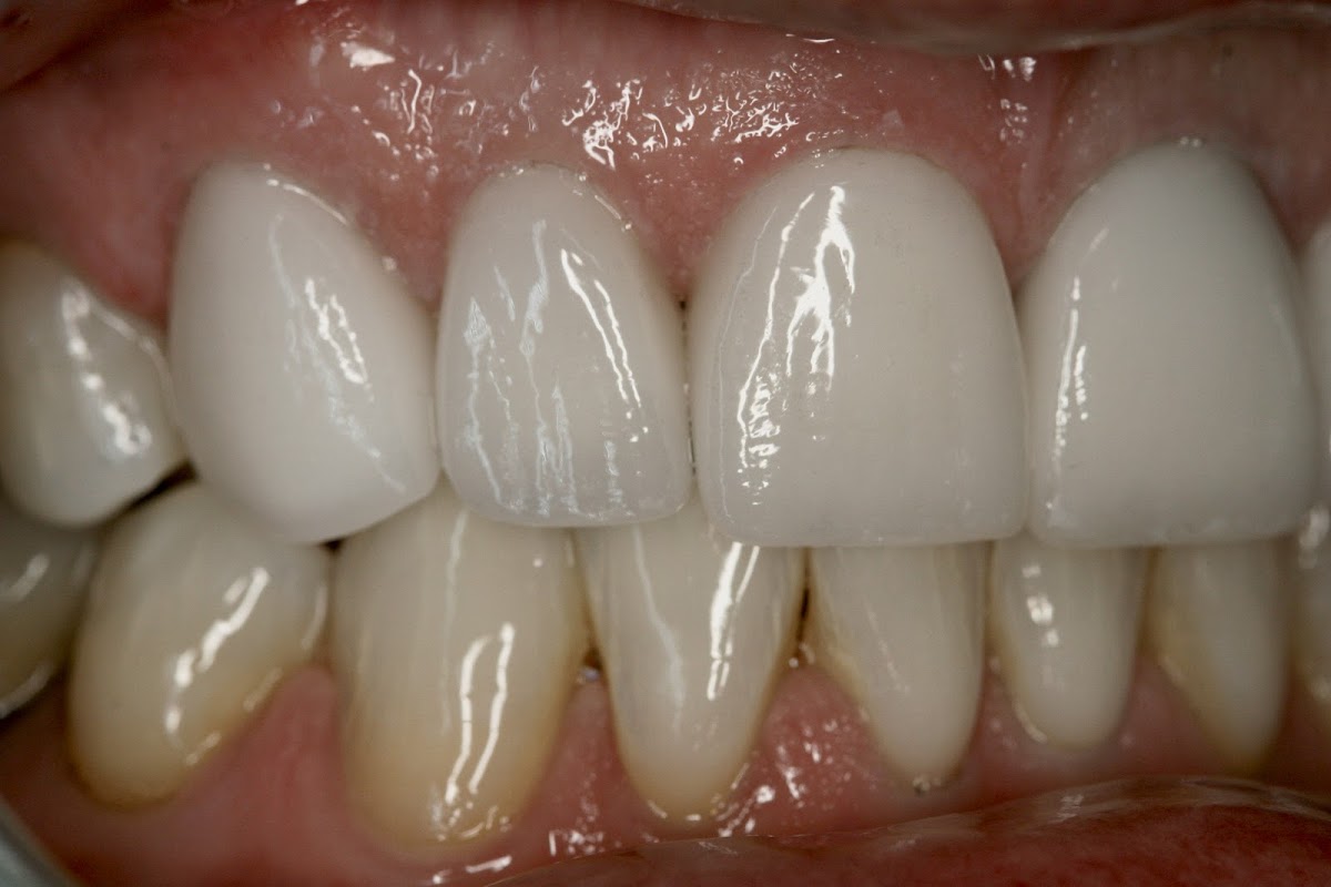 Gold Dust Dental Labratory photo 4