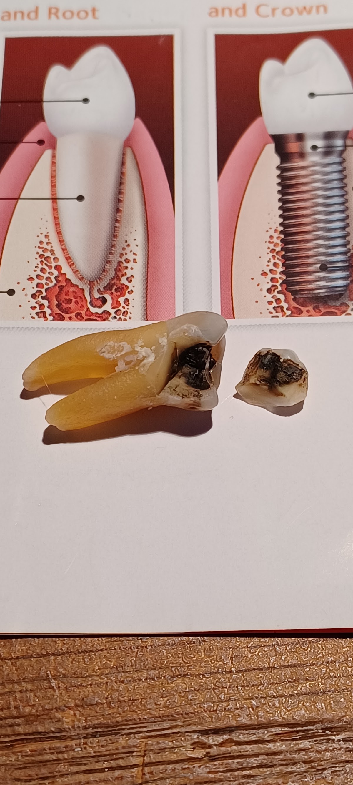 Lorton Springfield Dental Implant & Oral Surgery photo 4