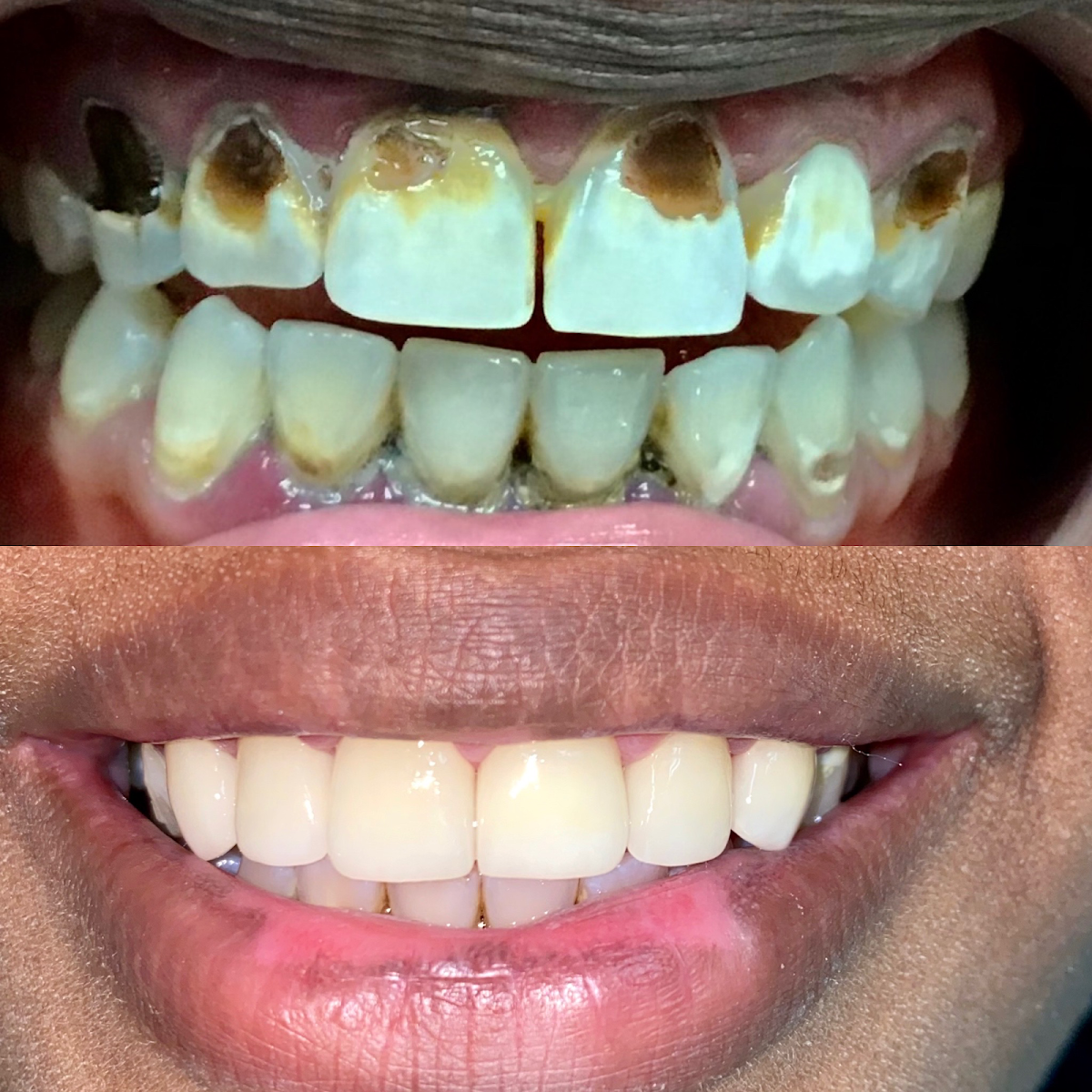 Las Olas Family Dental and Implant Center, Dr. Dennis Sevel photo 3