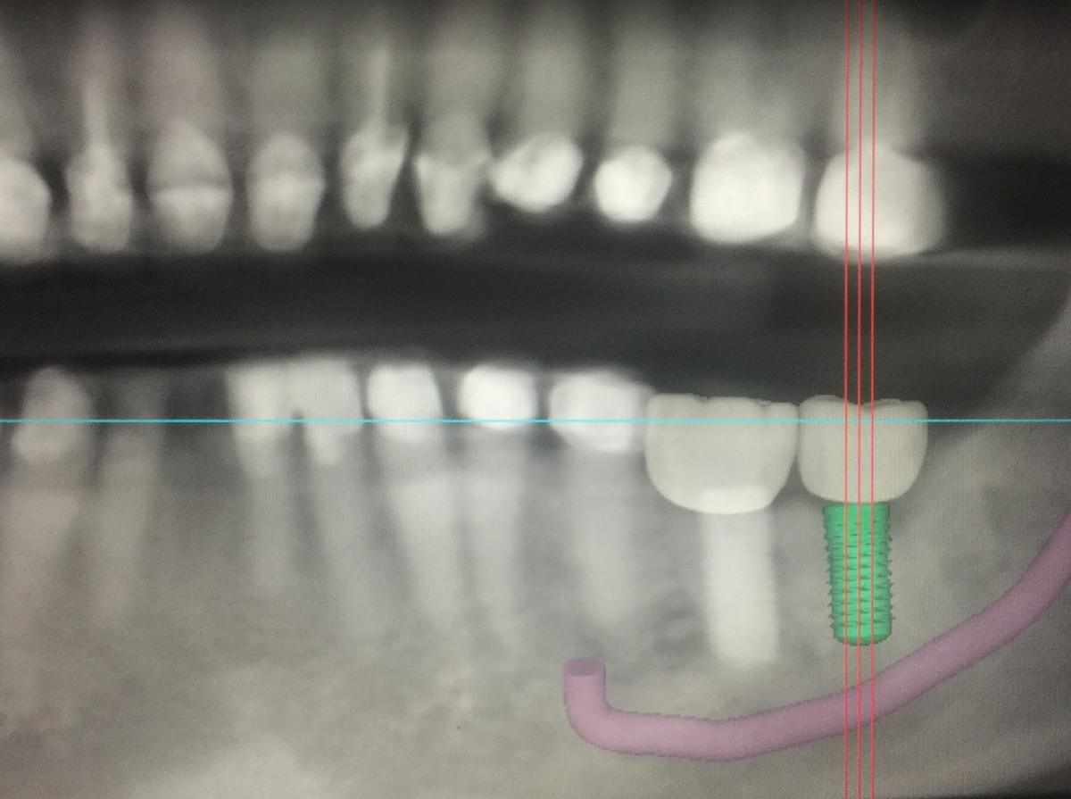 Long Beach Oral And Maxillofacial Surgery photo 4