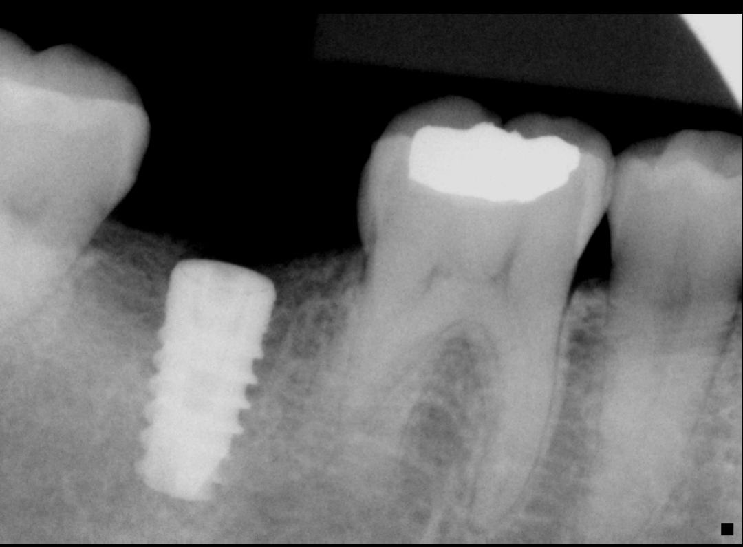 Long Beach Oral And Maxillofacial Surgery photo 5
