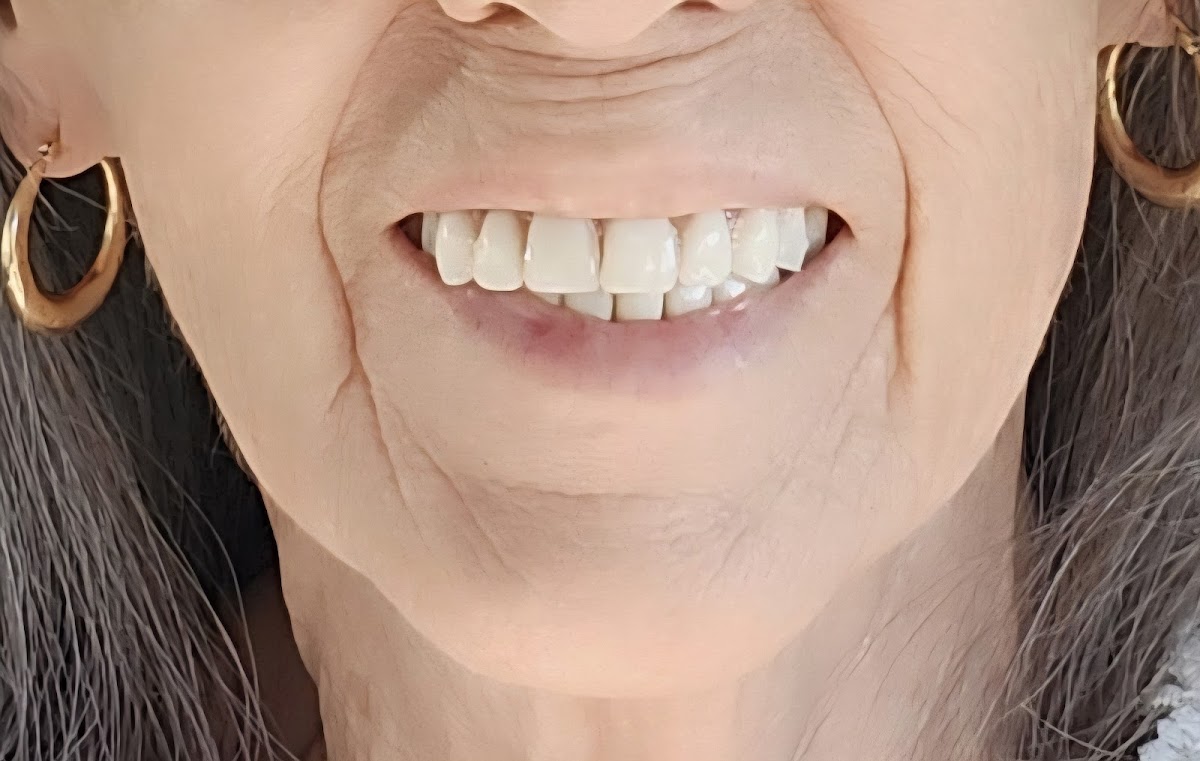 Aspen Dental - Muskogee photo 6