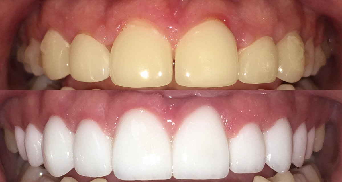 Pineview Dental Care: Dr. Adam J. Myers, DDS photo 3