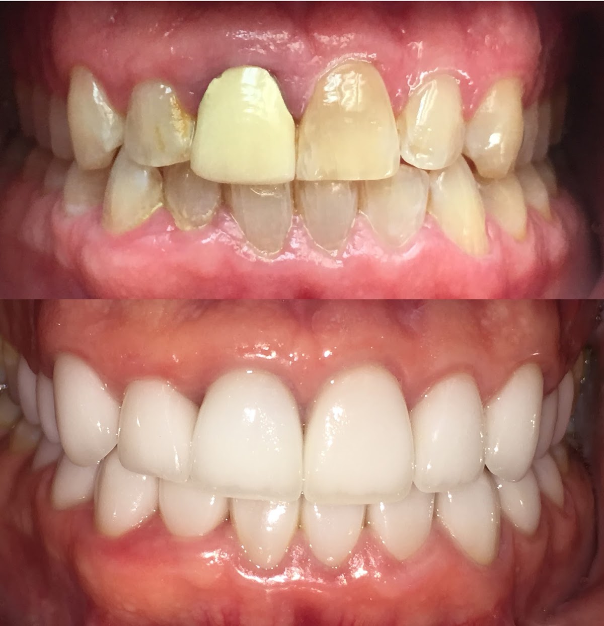 Pineview Dental Care: Dr. Adam J. Myers, DDS photo 6