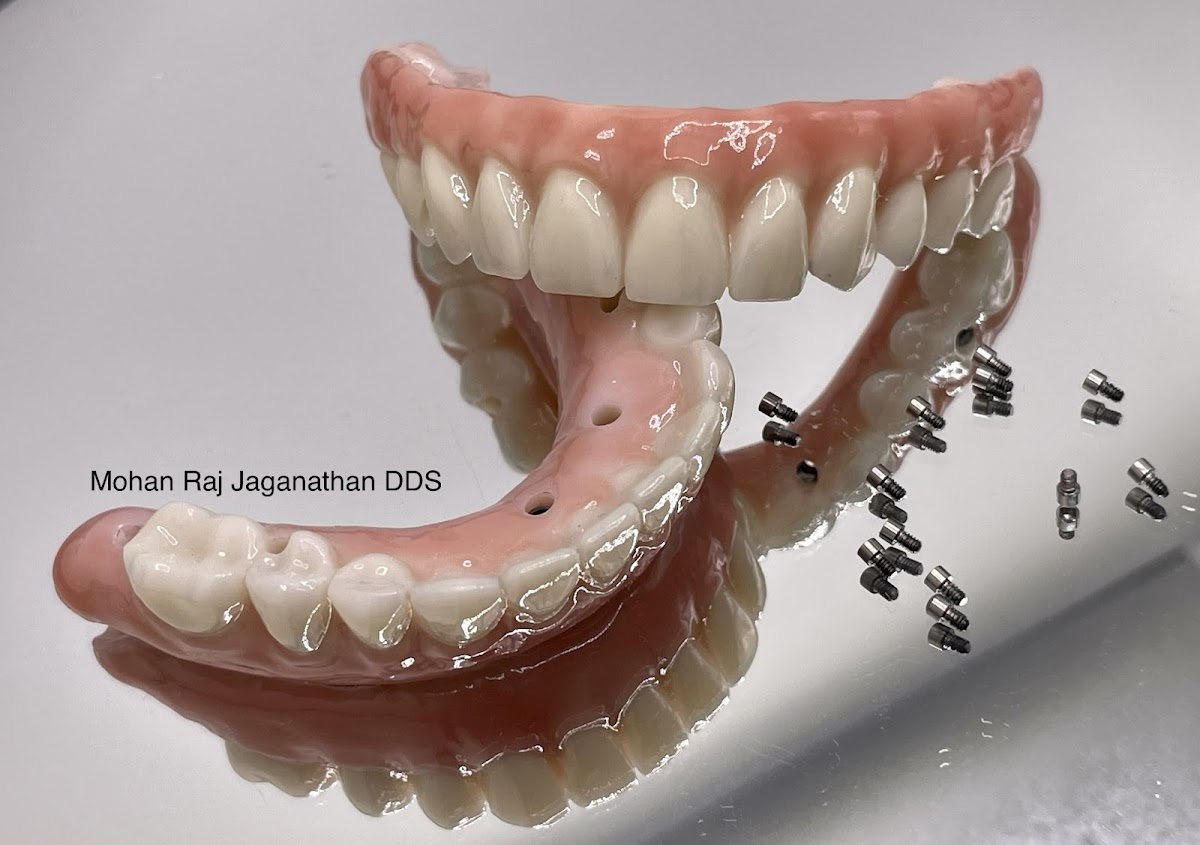 Elite Dental - Mohan Raj Jaganathan Dds & Veena Raja Dds Phd photo 3