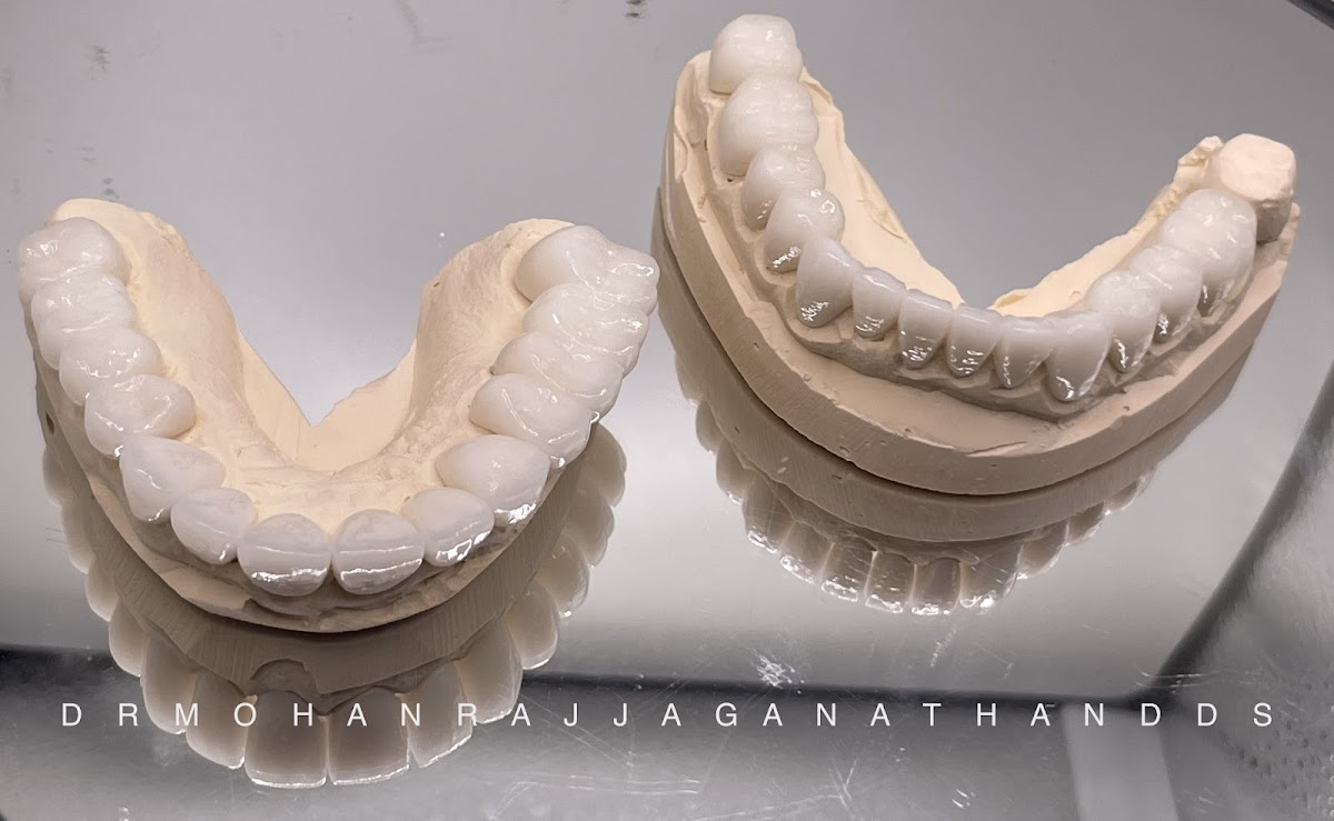 Elite Dental - Mohan Raj Jaganathan Dds & Veena Raja Dds Phd photo 4