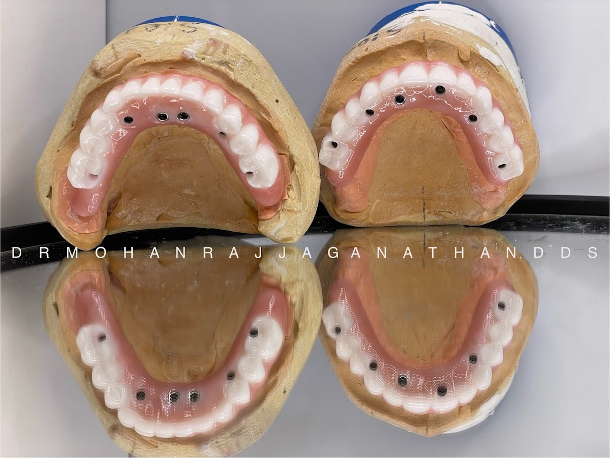 Elite Dental - Mohan Raj Jaganathan Dds & Veena Raja Dds Phd photo 5