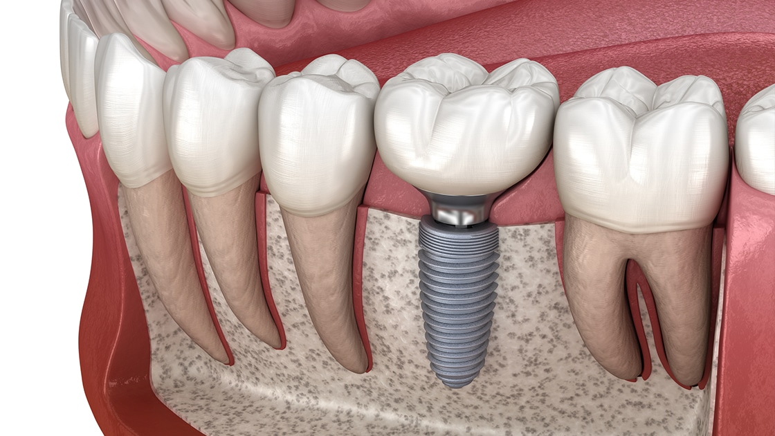 Crescent Family and Cosmetic Dentistry photo 1