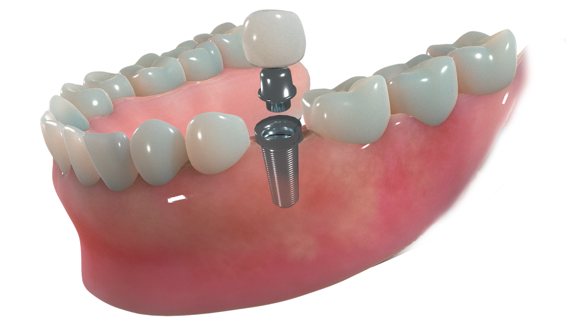 Crescent Family and Cosmetic Dentistry photo 2