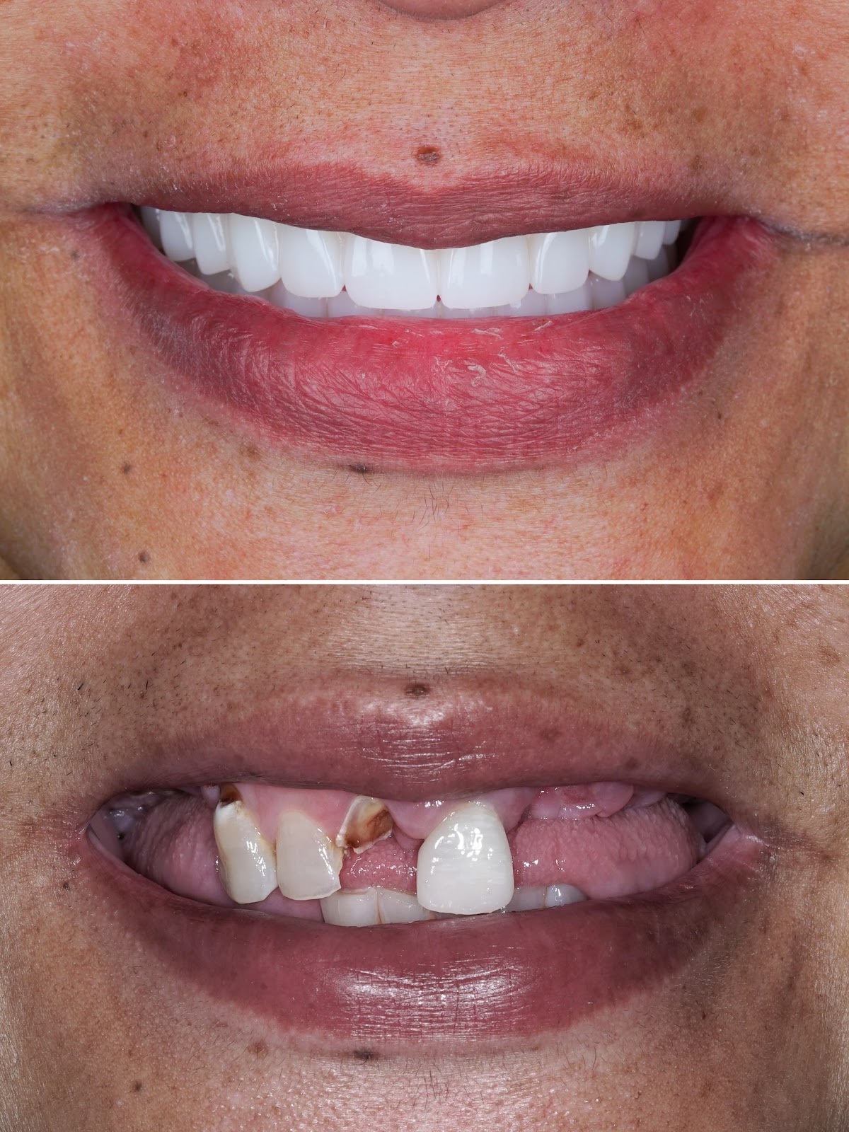 Eleve Dental Cosmetic & Implant Center photo 1