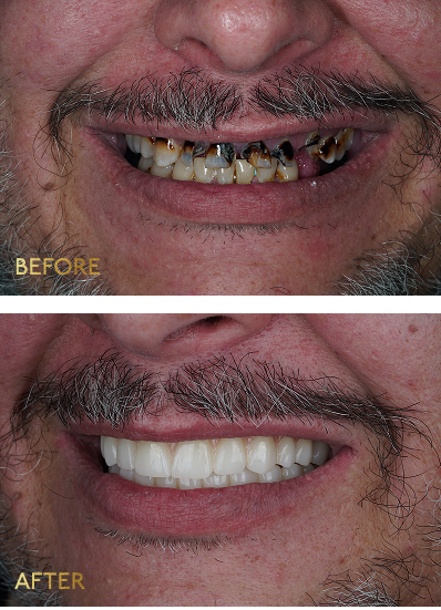 Eleve Dental Cosmetic & Implant Center photo 2