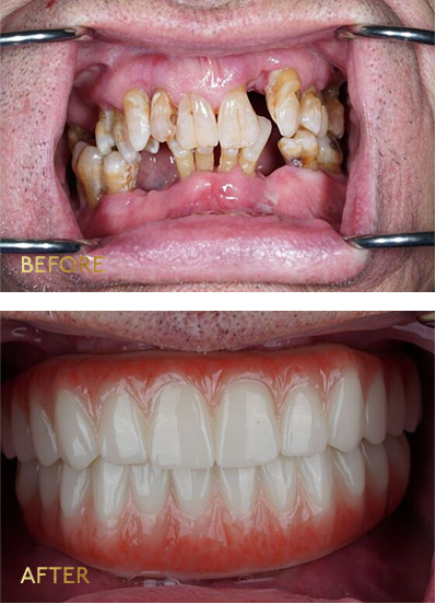 Eleve Dental Cosmetic & Implant Center photo 3