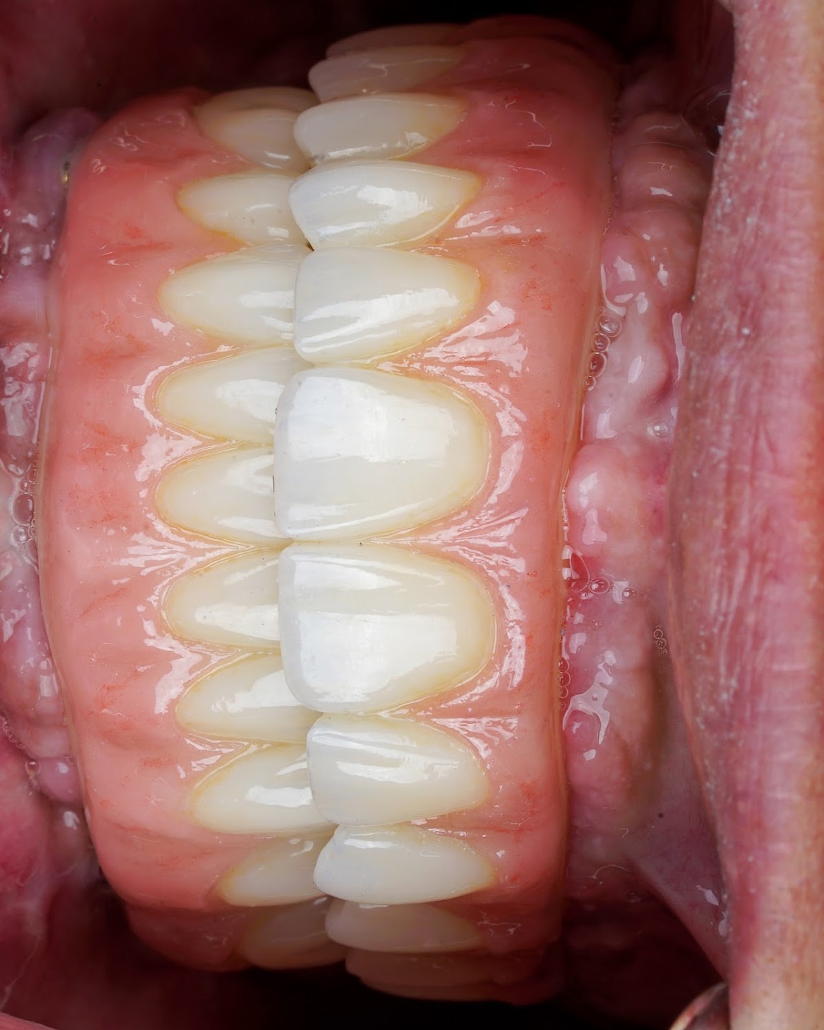 Eleve Dental Cosmetic & Implant Center photo 4