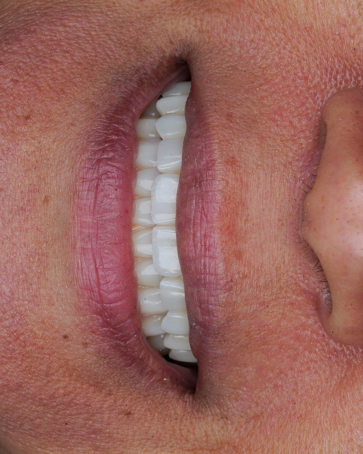 Eleve Dental Cosmetic & Implant Center photo 5