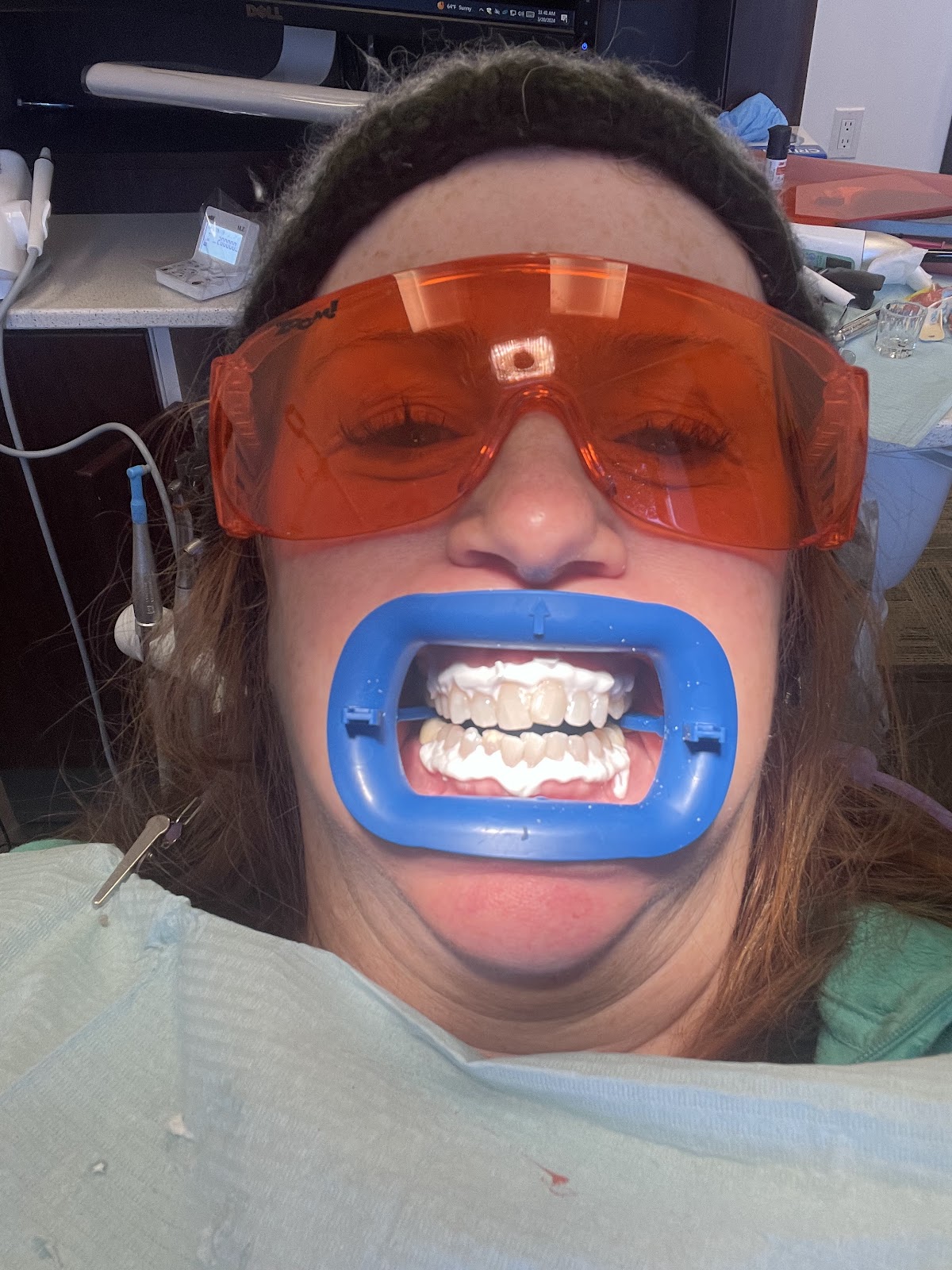 San Diego Downtown Dental Implant photo 3