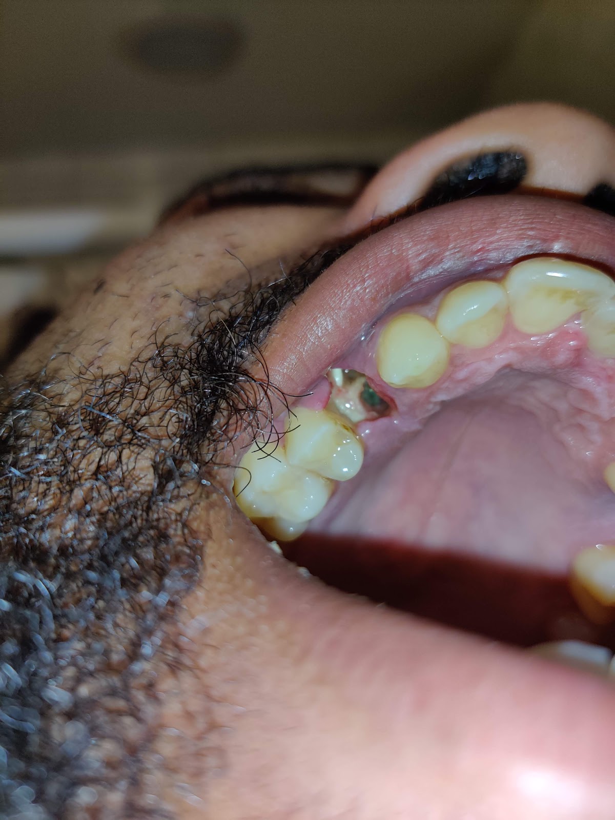 Aspen Dental - Cumming photo 5