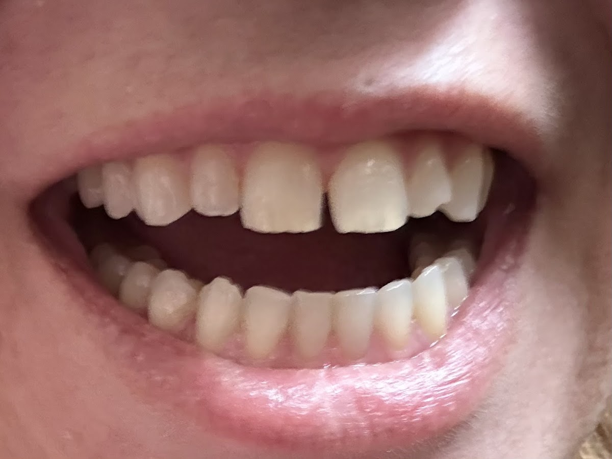 Aspen Dental - Warsaw photo 3