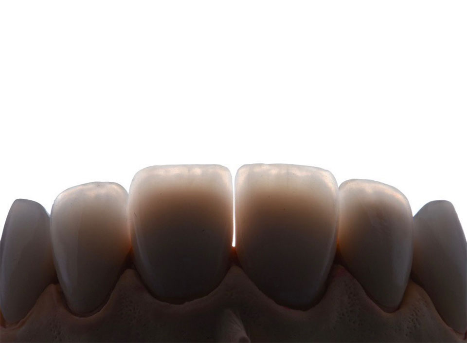 Mint Smiles Dentist - Rancho Cucamonga photo 4