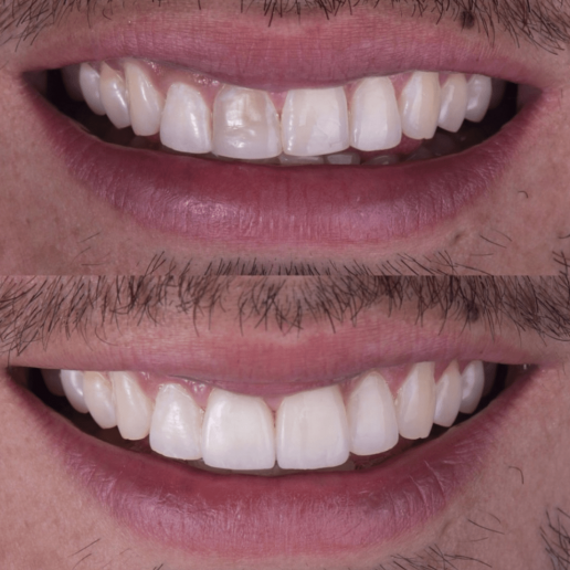 Mint Smiles Dentist - Rancho Cucamonga photo 6