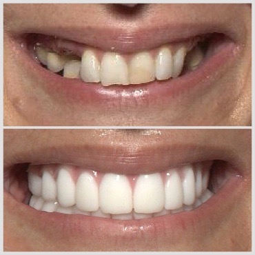 Dental Implants of Spring Hill photo 1