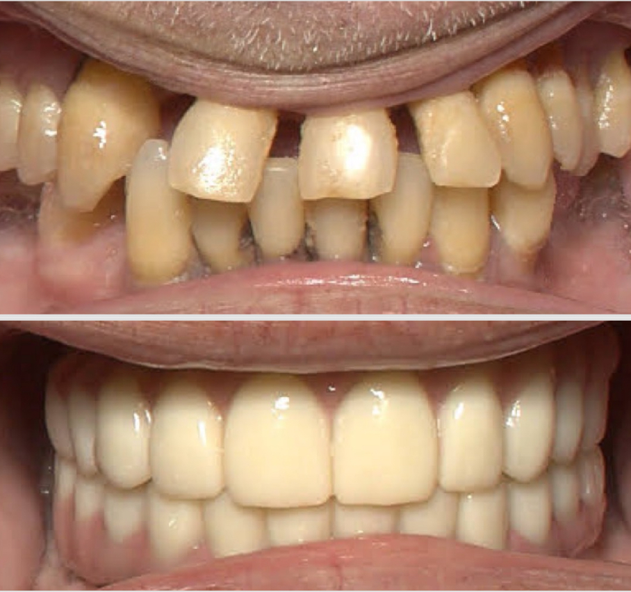 Dental Implants of Spring Hill photo 2