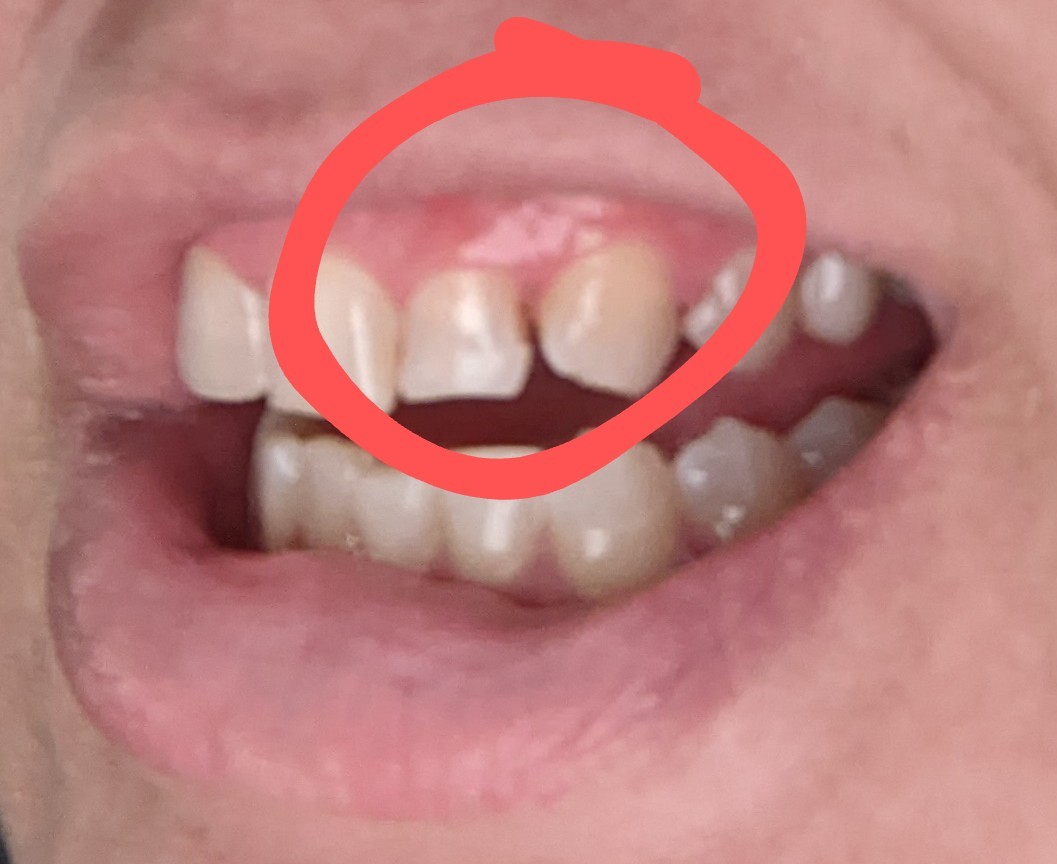 Iowa City Dental Health photo 4