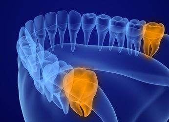 Midwest Oral Maxillofacial & Implant Surgery photo 3