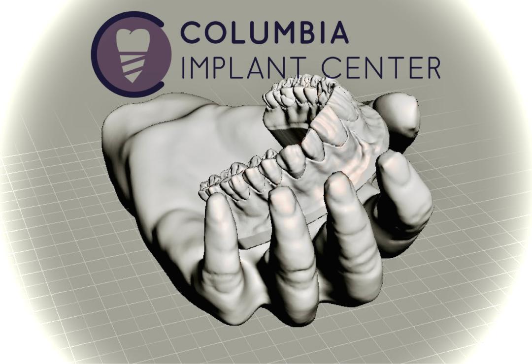 Columbia Implant Center photo 1