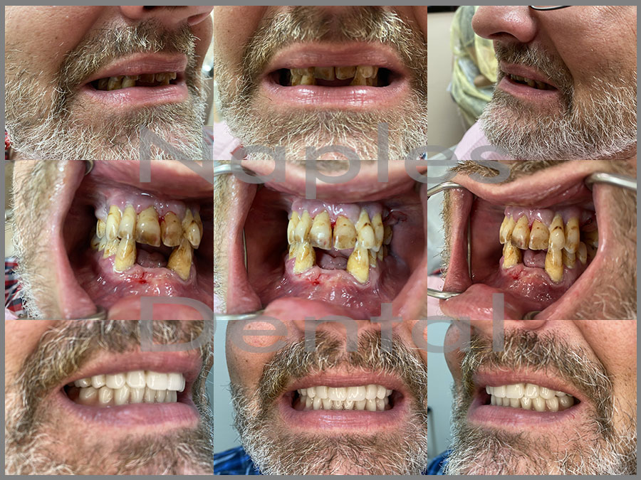 Naples Dental and Implant Center photo 5