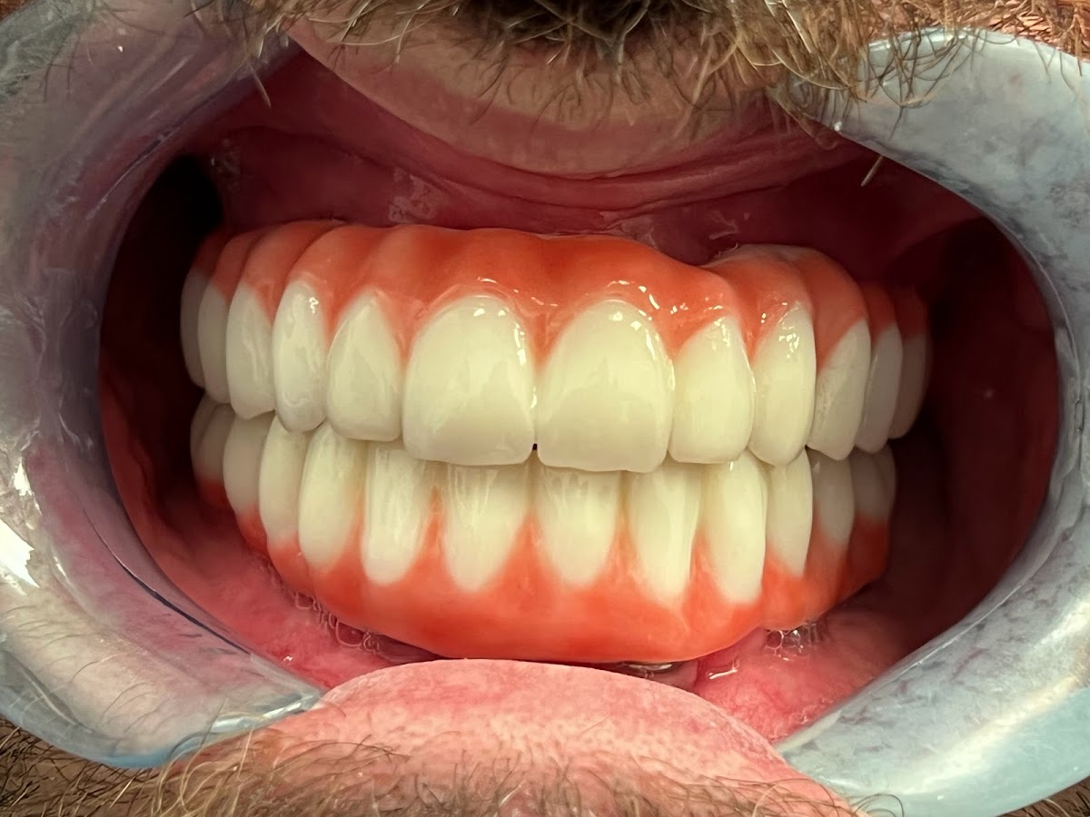 Lyon Dental Implants and Oral Surgery photo 4