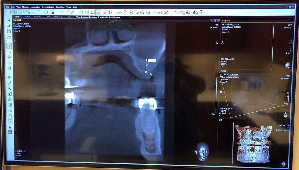 Capital Oral & Facial Surgery @ Holly Springs photo 6