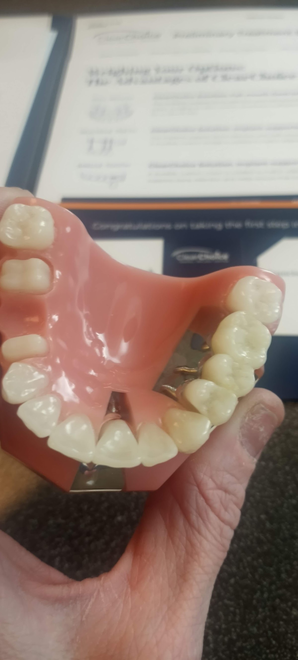 Clearchoice Dental Implant Center - Bellevue photo 5