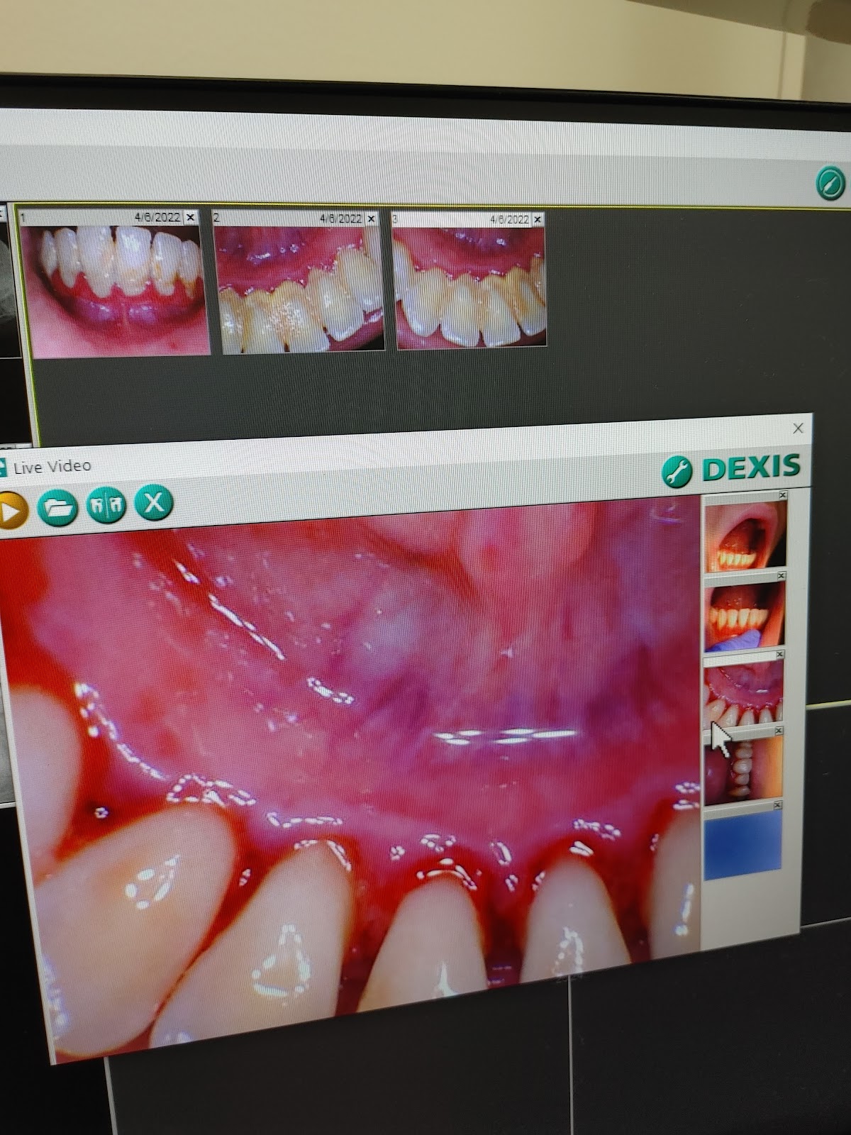 Dentist in Winston Salem photo 2