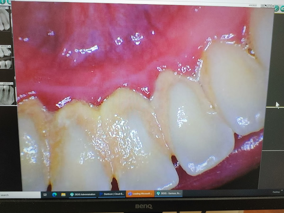 Dentist in Winston Salem photo 4