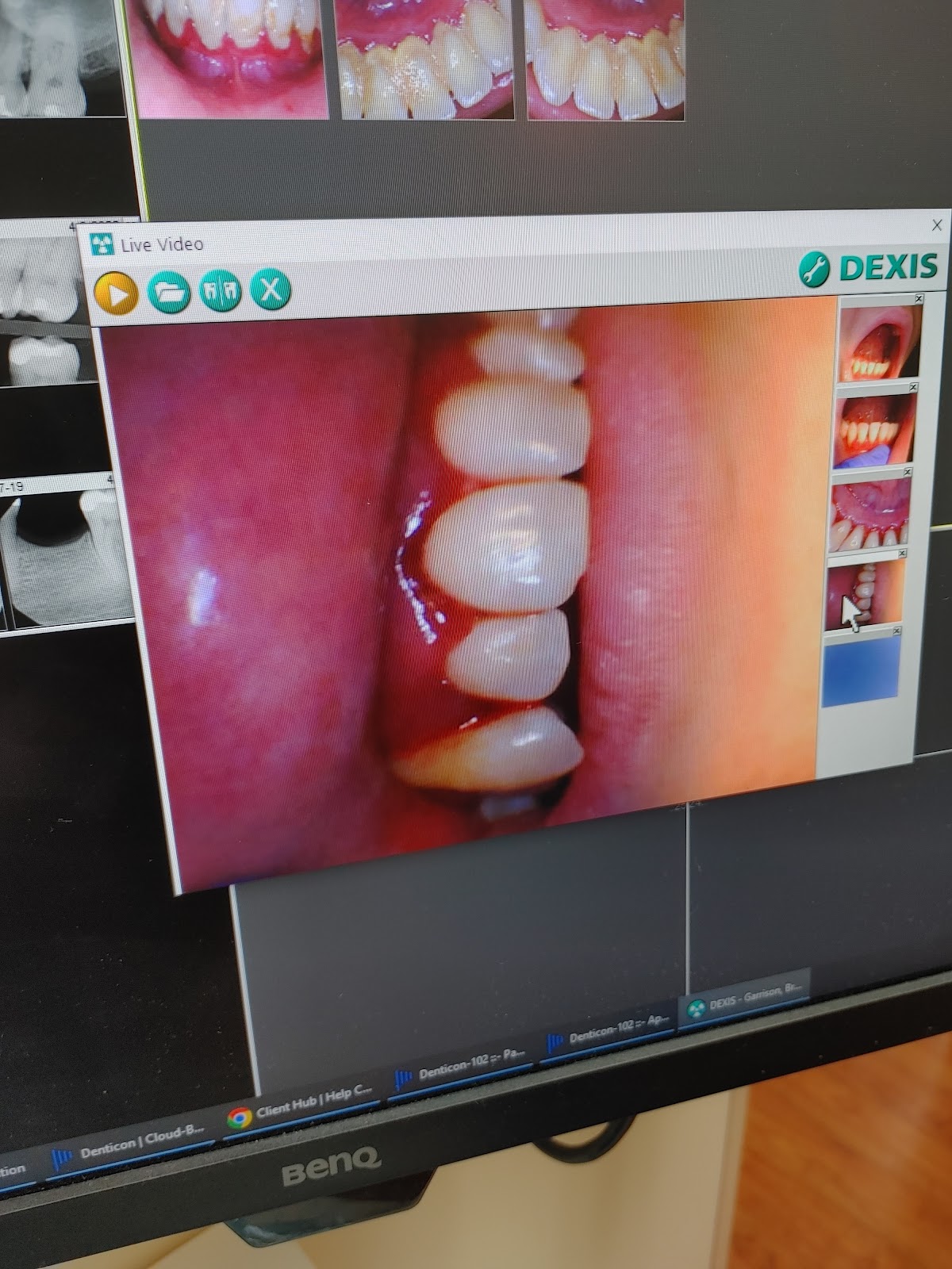 Dentist in Winston Salem photo 6