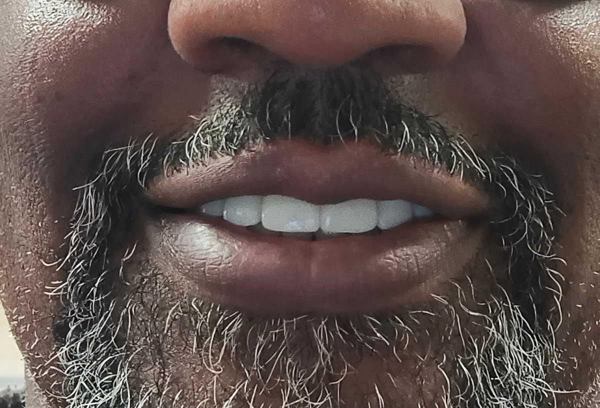 Plaza Dental Associates photo 5